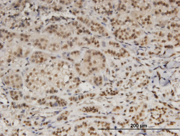 Immunoperoxidase of monoclonal antibody to DDB1 on formalin-fixed paraffin-embedded human adrenal gland. [antibody concentration 3 ug/ml]
