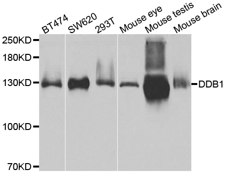 Western blot analysis of extracts of various cell lines, using DDB1 antibody.