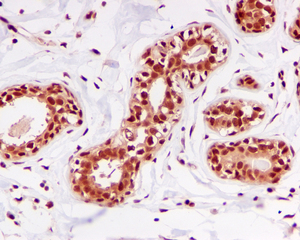 IHC of paraffin-embedded human breast tissue using anti-DDB1 antibody. 