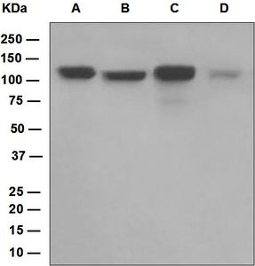 Western blot analysis on (A) HepG2, (B) HeLa, (C) NIH/3T3, and (D) human platelet lysates using anti-DDB1 antibody.