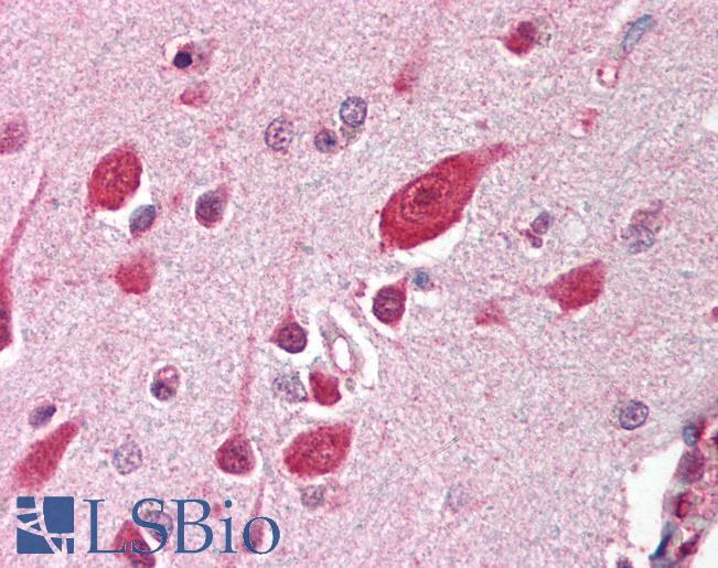 Anti-DDB1 antibody IHC of human brain, cortex. Immunohistochemistry of formalin-fixed, paraffin-embedded tissue after heat-induced antigen retrieval. Antibody LS-B364 dilution 1:500.