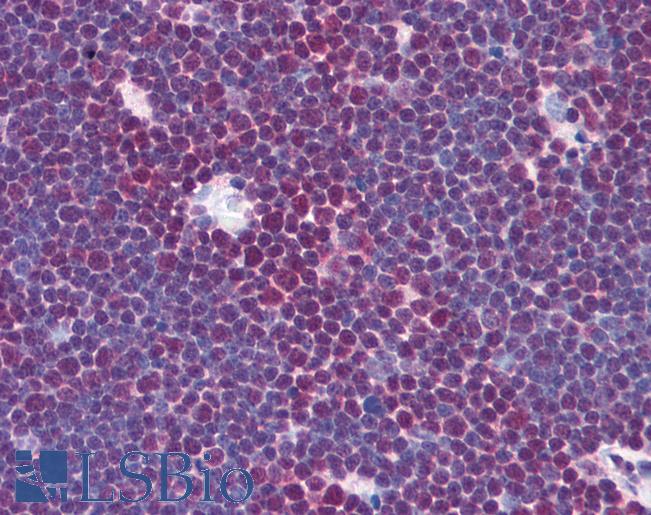 Anti-DDB1 antibody IHC of human thymus. Immunohistochemistry of formalin-fixed, paraffin-embedded tissue after heat-induced antigen retrieval. Antibody LS-B1691 concentration 5 ug/ml.