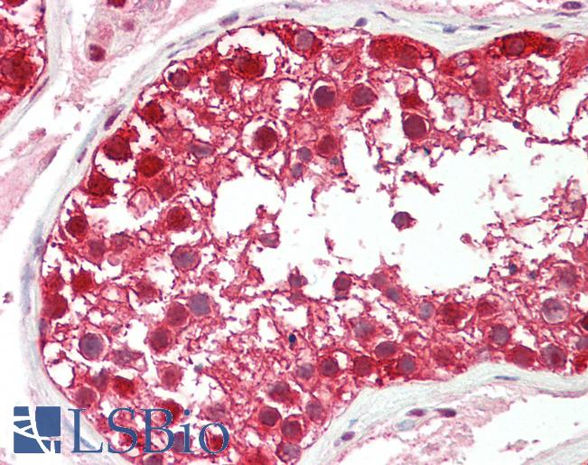 Anti-DDB1 antibody IHC staining of human testis. Immunohistochemistry of formalin-fixed, paraffin-embedded tissue after heat-induced antigen retrieval. Antibody LS-B11164 concentration 5 ug/ml.