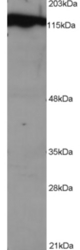 Anti-DDB1 Antibody(1 µg/ml) staining of NSO lysate (1E5 cells per lane). Detected using chemiluminescence.