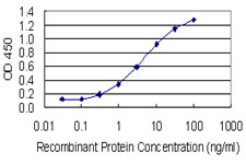 Detection limit for recombinant GST tagged AKR1C1 is 0.1 ng/ml as a capture antibody.