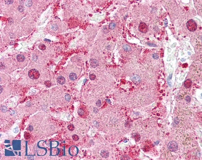 Anti-AKR1C1 antibody IHC of human liver. Immunohistochemistry of formalin-fixed, paraffin-embedded tissue after heat-induced antigen retrieval. Antibody LS-B6269 concentration 10 ug/ml.