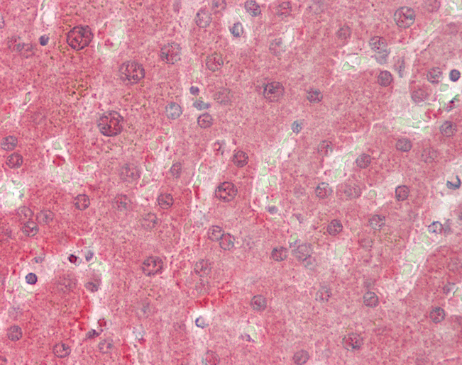 Human Liver: Formalin-Fixed, Paraffin-Embedded (FFPE)