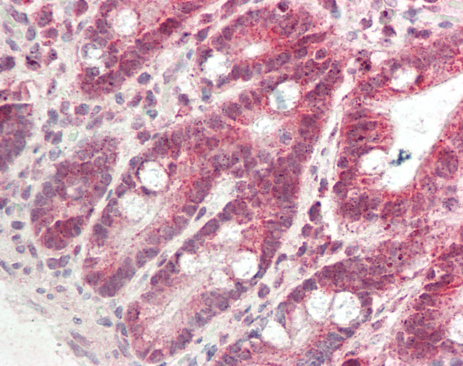 Human Small Intestine: Formalin-Fixed, Paraffin-Embedded (FFPE)
