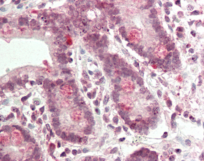 Human Small Intestine: Formalin-Fixed, Paraffin-Embedded (FFPE)