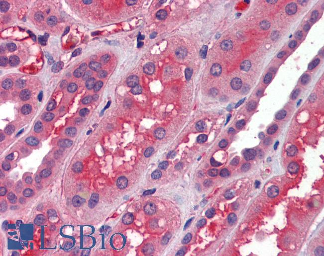 Anti-DDIT3 / GADD153 antibody IHC of human kidney. Immunohistochemistry of formalin-fixed, paraffin-embedded tissue after heat-induced antigen retrieval. Antibody LS-B3652 concentration 5 ug/ml.