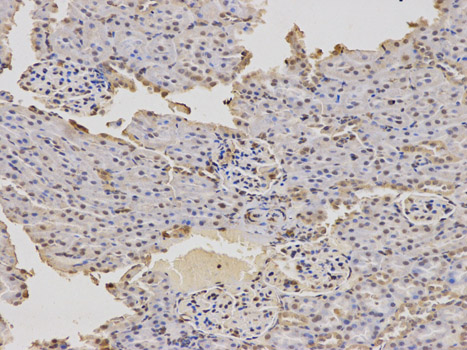 Immunohistochemistry of paraffin-embedded rat kidney using DDIT3 antibody at dilution of 1:100 (200x lens).