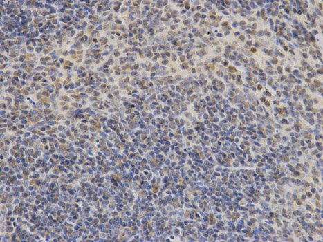 Immunohistochemistry of paraffin-embedded mouse spleen using DDIT3 antibody at dilution of 1:100 (400x lens).