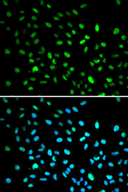 Immunofluorescence analysis of A549 cell using DDIT3 antibody. Blue: DAPI for nuclear staining.
