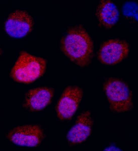 Detection of Human REDD1 by Immunocytochemistry. Sample: NBF-fixed asynchronous, Cobalt-treated HeLa cells. Antibody: Affinity purified rabbit anti-REDD1 used at a dilution of 1:500 (2 ug/ml). Detection: Red-fluorescent goat anti-rabbit IgG H&L cross-adsorbed Antibody DyLight594(A120-601D4) used at a dilution of 1:100.