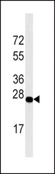 Western blot of DDIT4 Antibody in Jurkat cell line lysates (35 ug/lane). DDIT4 (arrow) was detected using the purified antibody.
