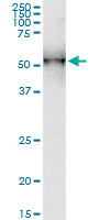 DDOST monoclonal antibody (M06), clone 2D7. Western Blot analysis of DDOST expression in human stomach.