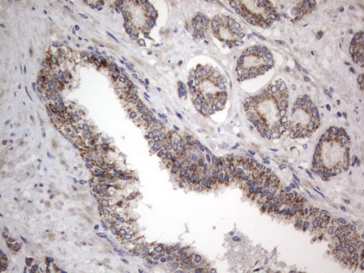 IHC of paraffin-embedded Human prostate tissue using anti-DDOST mouse monoclonal antibody. (Heat-induced epitope retrieval by 1 mM EDTA in 10mM Tris, pH8.5, 120°C for 3min).