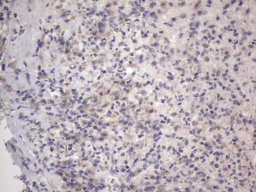 IHC of paraffin-embedded Human lymph node tissue using anti-DDOST mouse monoclonal antibody. (Heat-induced epitope retrieval by 1 mM EDTA in 10mM Tris, pH8.5, 120°C for 3min).