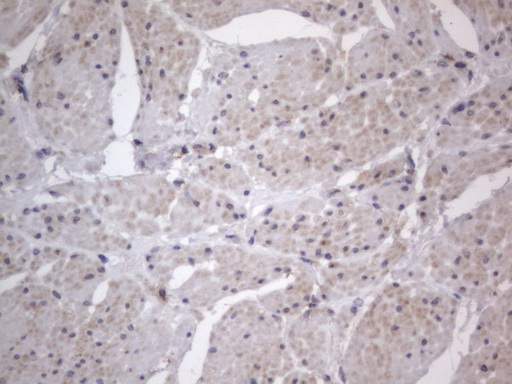 IHC of paraffin-embedded Human bladder tissue using anti-DDOST mouse monoclonal antibody. (Heat-induced epitope retrieval by 1 mM EDTA in 10mM Tris, pH8.5, 120°C for 3min).