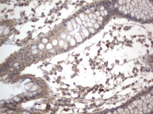 IHC of paraffin-embedded Human colon tissue using anti-DDOST mouse monoclonal antibody. (Heat-induced epitope retrieval by 1 mM EDTA in 10mM Tris, pH8.5, 120°C for 3min).