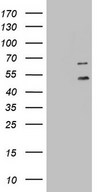 HEK293T cells were transfected with the pCMV6-ENTRY control (Left lane) or pCMV6-ENTRY DDOST (Right lane) cDNA for 48 hrs and lysed. Equivalent amounts of cell lysates (5 ug per lane) were separated by SDS-PAGE and immunoblotted with anti-DDOST.