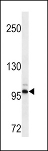 DDR2 Antibody western blot of HepG2 cell line lysates (35 ug/lane). The DDR2 antibody detected the DDR2 protein (arrow).