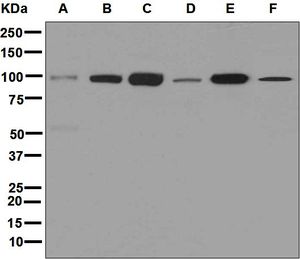 Western blot analysis on (A) HepG2, (B) HeLa, (C) Jurkat, (D) 293T, (E) NIH/3T3, and (F) A431 cell lysates using anti-DDR2 antibody.