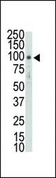Western blot of DDR2 (TYRO10) Antibody in HL-60 lysate. DDR2 (arrow) was detected using purified antibody. Secondary HRP-anti-rabbit was used for signal visualization with chemiluminescence.
