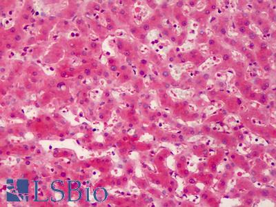 Anti-DDR2 antibody IHC of human liver. Immunohistochemistry of formalin-fixed, paraffin-embedded tissue after heat-induced antigen retrieval. Antibody LS-B3466 dilution 1:200.