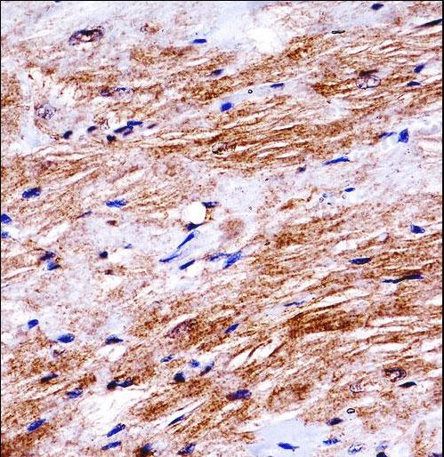Mouse Ddr2 Antibody immunohistochemistry of formalin-fixed and paraffin-embedded mouse heart tissue followed by peroxidase-conjugated secondary antibody and DAB staining.