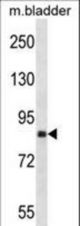 Mouse Ddr2 Antibody western blot of mouse bladder tissue lysates (35 ug/lane). The Ddr2 antibody detected the Ddr2 protein (arrow).