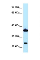 AKR1C3 antibody LS-C145932 Western blot of COL0205 Cell lysate. Antibody concentration 1 ug/ml.