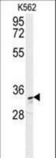 AKR1C3 Antibody western blot of K562 cell line lysates (35 ug/lane). The AKR1C3 antibody detected the AKR1C3 protein (arrow).