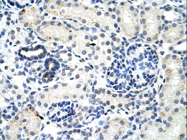 DDX17 antibody LS-C31694 was used in IHC to stain formalin-fixed, paraffin-embedded human kidney.