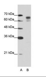 A: Marker, B: Jurkat Cell Lysate