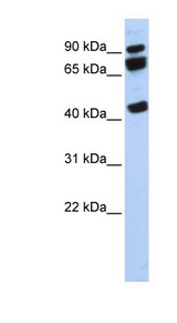 DDX17 antibody LS-C110150 Western blot of 721_B cell lysate.