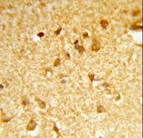 Formalin-fixed and paraffin-embedded human brain tissue reacted with DDX17 Antibody , which was peroxidase-conjugated to the secondary antibody, followed by DAB staining. This data demonstrates the use of this antibody for immunohistochemistry; clinical relevance has not been evaluated.