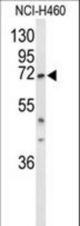 Western blot of DDX17 Antibody in NCI-H460 cell line lysates (35 ug/lane). DDX17 (arrow) was detected using the purified antibody.