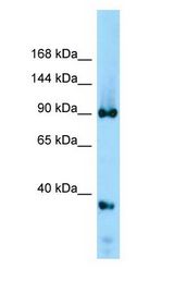 DDX20 / GEMIN3 antibody Western Blot of Rat Kidney. Antibody dilution: 1 ug/ml.
