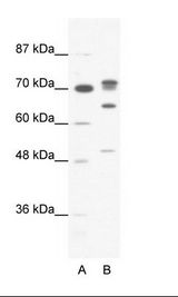 A: Marker, B: HepG2 Cell Lysate