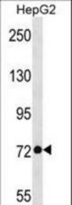DDX21 Antibody western blot of HepG2 cell line lysates (35 ug/lane). The DDX21 antibody detected the DDX21 protein (arrow).