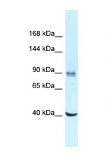 DDX23 antibody LS-C145854 Western blot of Jurkat Cell lysate. Antibody concentration 1 ug/ml.