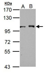 Sample (30 ug of whole cell lysate) A: NIH-3T3 B: JC 7.5% SDS PAGE DDX23 antibody diluted at 1:1000