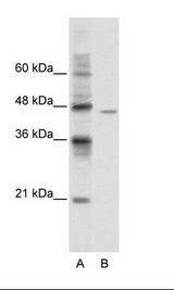 A: Marker, B: Jurkat Cell Lysate
