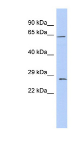 CLDN18 / Claudin 18 antibody LS-C109817 Western blot of Fetal Thymus lysate.