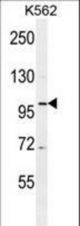 DDX27 Antibody western blot of K562 cell line lysates (35 ug/lane). The DDX27 antibody detected the DDX27 protein (arrow).