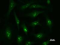 Immunostaining analysis in HeLa cells. HeLa cells were fixed with 4% paraformaldehyde and permeabilized with 0.1% Triton X-100 in PBS. The cells were immunostained with anti-DDX27 mAb.