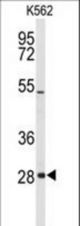 Western blot of CLDN18 Antibody in K562 cell line lysates (35 ug/lane). CLDN18 (arrow) was detected using the purified antibody.