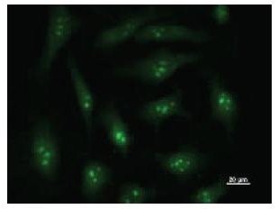 Immunofluorescent staining using DDX27 antibody. Immunostaining analysis in HeLa cells. HeLa cells were fixed with 4% paraformaldehyde and permeabilized with 0.01% Triton-X100 in PBS. The cells were immunostained with anti-DDX27 antibody.