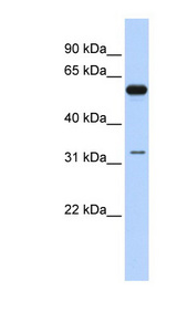 DDX28 antibody LS-C110164 Western blot of Fetal Brain lysate.